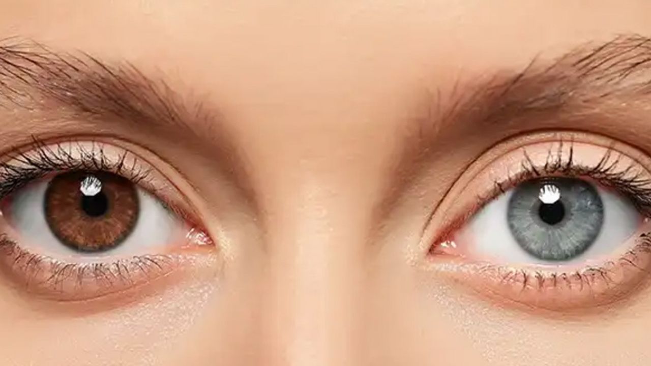 Göz rengini değiştirmek moda oldu: Yurt dışından talep yağıyor