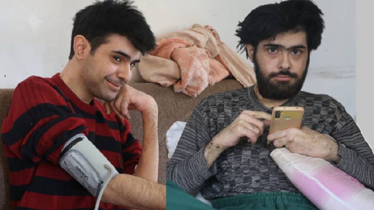 Türkiye'yi üzen, evden çıkmayan Barış'a teşhis kondu: 3 yıldır yıkanmamıştı