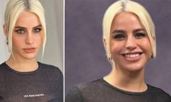 Büşra Pekin'in yüzündeki değişim estetik değil, filtre çıktı! Ünlü isim itiraf etti!