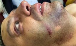 Cumhur ittifakı birbirne girdi! AK Parti'li Teşkilat Başkanı Musa Derin öldüresiye dövüldü
