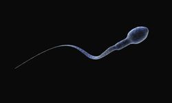 Sperm sayıları yıllardır düşüyor! Suçlulardan biri mikroplastikler mi?