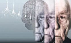 Alzheimer ve bunama belirtileri nelerdir?