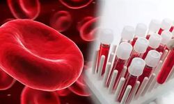 ‘A kan grubundakilerde mide kanseri riski fazla’