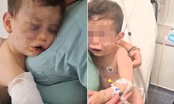 Denizli'de vahşet! 2 yaşındaki çocuk annesinin erkek arkadaşı tarafından darp edildi!