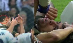 Beşiktaş - Adana Demirspor maçına sakatlık damgası: Bir oyuncunun dişi kırıldı