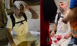 Hüda Par Milletvekili Mısır'da yaralandı!