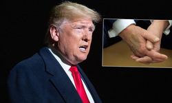 Tartışma yarattı: Trump’ın elindeki gizemli leke ne?