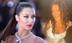 Bella Hadid sevenlerini korkuttu! Lyme hastalığıyla mücadelesini böyle paylaştı