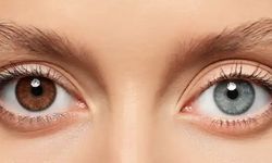 Göz rengini değiştirmek moda oldu: Yurt dışından talep yağıyor
