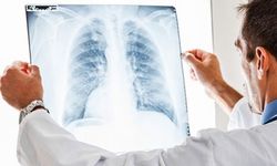 Akciğer sağlığınızı tehdit eden 5 önemli faktör