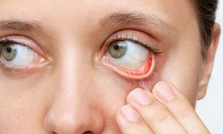 Dünyada 17 milyon kişi katarakt nedeniyle görme kaybı yaşıyor