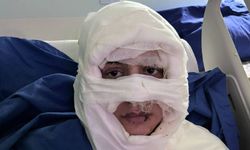 Kadıköy'de genç kadını kolonyayla yakan şüpheli tutuklandı