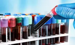 Kan testiyle kanser teşhisinde devrim niteliğinde gelişme!