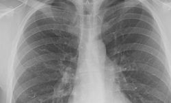 5 dakikalık kontrol hayatını değiştirebilir