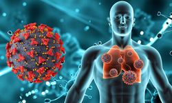 "Hafife alınan zatürre ölümünüze neden olabilir"