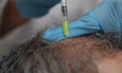 Dökülen saçlar vücudun bir alarmı olabilir