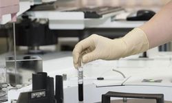 Vücutta gizlenen tümör, bağışıklık sistemini harekete geçiren "immünoterapi" ile yok ediliyor