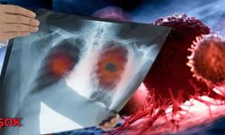 Türkiye’nin kanser haritası yayımlandı: İlk sıradaki şehir herkesi şaşırttı! İşte tüm liste!