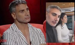 Doğuş’un yüzüne ne oldu? Sosyal medya 'güncelleme gelmiş' dedi!