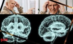 Alzheimer tedavisinde devrim: İyileşme artık mümkün mü?