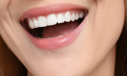 Diş kaybı yalnızca estetik bir sorun değil!