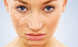 Soğuk havalarda cilt kuruluğuna son! İşte 10 etkili tavsiye
