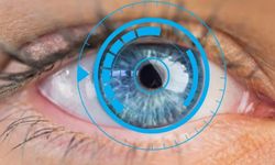 Katarakt ameliyatı bunama riskini azaltabilir...