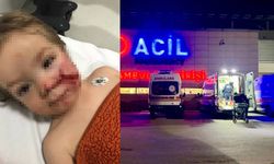 Ankara'da pitbull dehşeti: İki kardeşe saldırdı