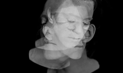 Diyetle şizofreni tedavisi mümkün mü? Uzmanlardan şok açıklama