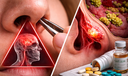 Burun kılını koparanlar dikkat: Bu alışkanlık ölüm riski taşıyor!