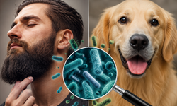 Köpekler erkeklerden temiz çıktı: Bilim insanlarına göre sakallar bakteri yuvası