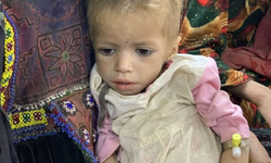 UNICEF: Afganistan'da 3,7 milyon çocuk yetersiz beslenmeyle karşı karşıya
