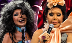 Bülent Ersoy yüzünü 'lolita gibi' yaptırmıştı! Aylar sonra böyle görüntülendi