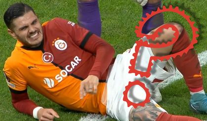 Mauro Icardi ameliyata hazır: Sahalara dönüş tarihi ise taraftarı üzdü!