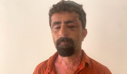 Öfkeli damat dehşet saçtı: Kayınpederini hastanelik etti