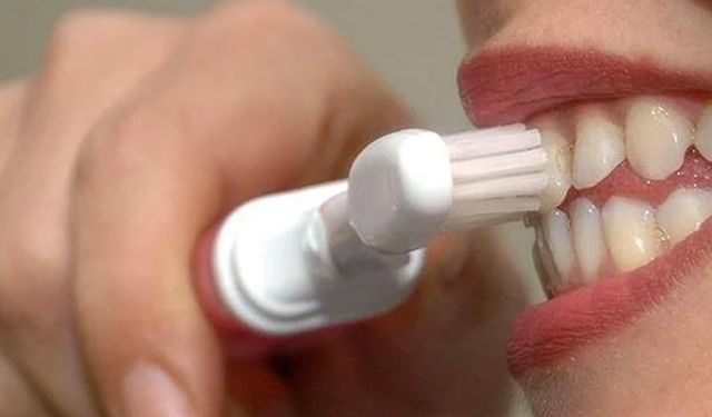 İnternetten alınan diş beyazlatma kitleri için "zarar verebilir" uyarısı