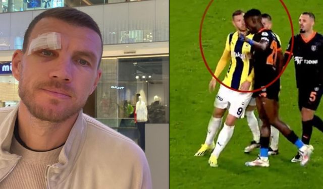 Edin Dzeko gözünün son halini paylaştı