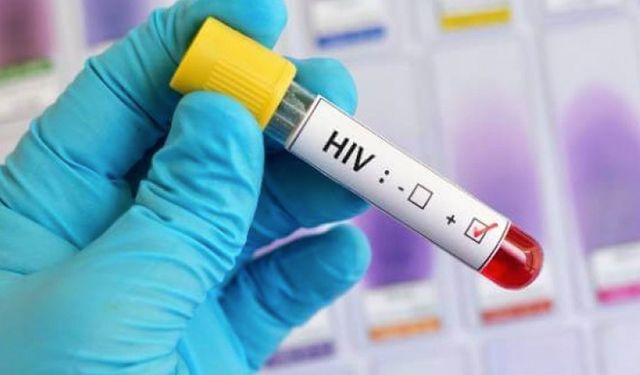 Yoksul ülkelere HIV önleme ilacı dağıtılacak