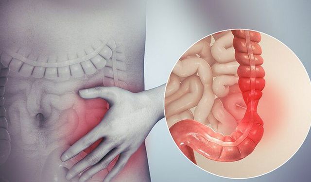 Milyonlarca insanda görülebiliyor: Bu hastalığın belirtileri neler?