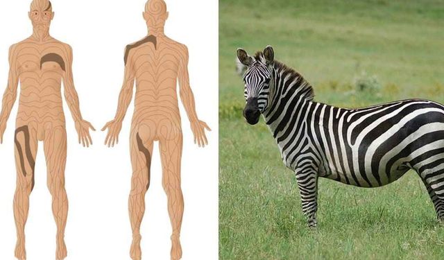 İnsanların zebra gibi çizgileri var: Ama normal gözle görülmüyorlar