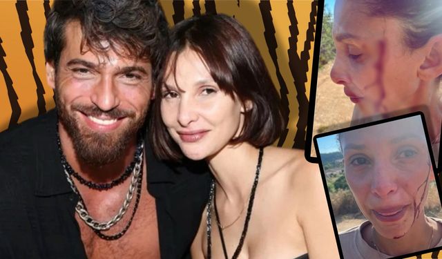 Can Yaman’ın sevgilisi Sara Bluma'dan olay ifşa: Şiddet gördüğünü açıkladı!