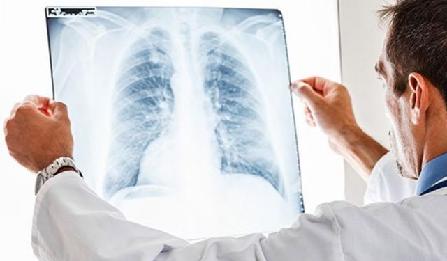 Akciğer sağlığınızı tehdit eden 5 önemli faktör