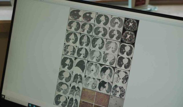 Gençlerde ani ölümler artıyor