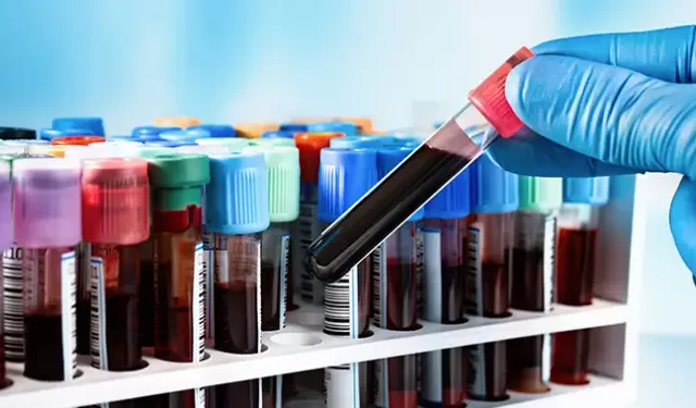 Kan testiyle kanser teşhisinde devrim niteliğinde gelişme!