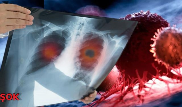 Türkiye’nin kanser haritası yayımlandı: İlk sıradaki şehir herkesi şaşırttı! İşte tüm liste!