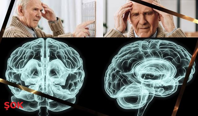 Alzheimer tedavisinde devrim: İyileşme artık mümkün mü?