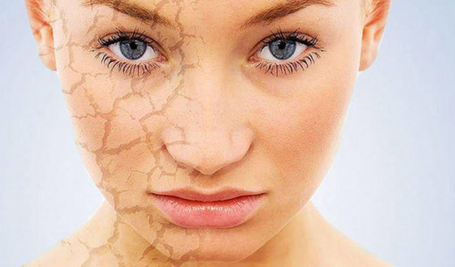 Soğuk havalarda cilt kuruluğuna son! İşte 10 etkili tavsiye