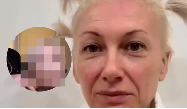 İzleyenler gözlerine inanamadı: 'Estetikle 20 yaş gençleşti'