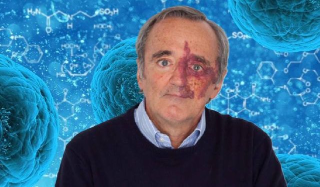 En ölümcül kanser ilk kez tamamen tedavi edildi! Bilim dünyası ayakta alkışladı