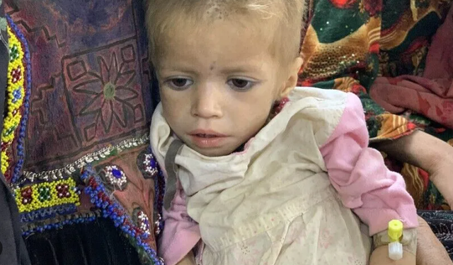 UNICEF: Afganistan'da 3,7 milyon çocuk yetersiz beslenmeyle karşı karşıya